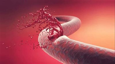 نقص أدوية مرضى الهيموفليا أمام صحة الشيوخ اليوم 