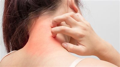 نصائح لتقليل الالتهاب المزمن.. تعرف عليها