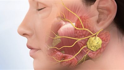 باحثون بجامعة بازل يكتشفون عضلة جديدة في جسم الإنسان