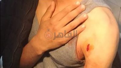 بتحريض من والدته.. طالب إعدادي يمزق وجه زميله بـ كتر أمام بوابة المدرسة بالمحلة