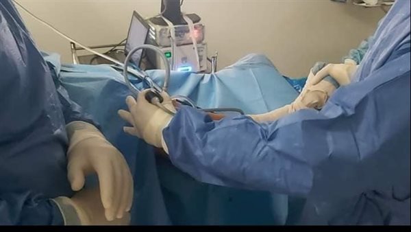 تغيير مفصل كامل بعظمة