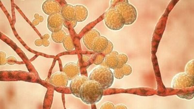 تهديد خطير للعالم.. اكتشاف 3 حالات مصابة بفطر البقع البيضاء بأمريكا