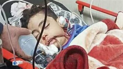 إصابة 3 أطفال إثر انهيار شرفة شقة سكنية في الغربية 