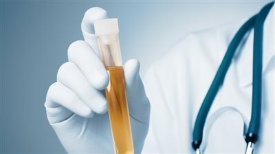 من بينها أمراض الكلى.. استشاري يوضح أسباب كثرة التبول | فيديو 