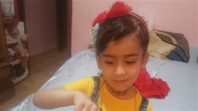 بنتي بتموت.. أب يستغيث بالمسؤولين لعلاج ابنته بعد تدهور حالتها إثر تناولها مادة كاوية | صور