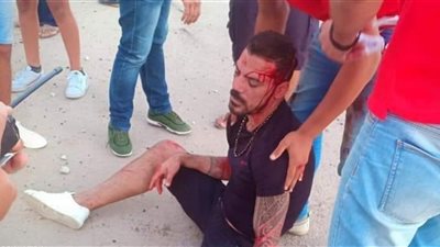 هؤلاء اللاعبين حرصوا على زيارة عمرو زكي فى المستشفى بعد حادث العلمين (صورة)