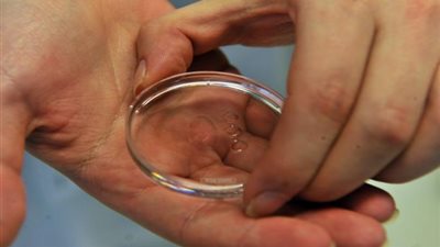 “القاهرة 24” يرصد القصة الكاملة لعمليات تجميد البويضات.. تعرف على مخاطرها وحكم الشرع فيها