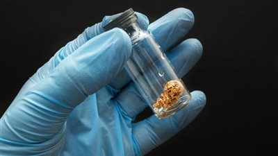 قيادي سلفي: لا يجوز تجميد البويضات خوفًا من اختلاط الأنساب