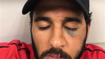 مروان محسن يجري عملية جراحية صباح اليوم