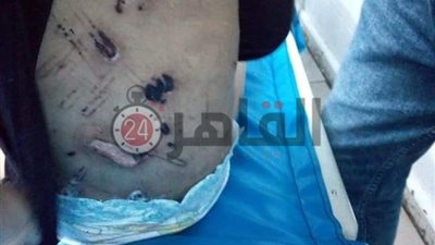 حبس سيدة عذبت حفيدتها بكي أعضاءها التناسلية بالدقهلية 15 يوماً