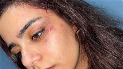 كان بيخبط دماغي في الحيط.. فتاة تستغيث من زوجها بعد 3 أشهر زواج | فيديو