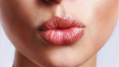 17 مشكلة ضمن أسباب تشقق الشفاه السفلى وكيفية علاجها