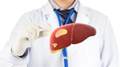 أعراض دهون الكبد وكيفية التخلص منها بـ 11 نصيحة طبية