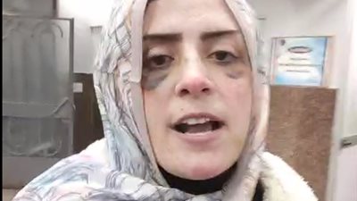 كدمات متفرقة بالجسم.. الأمن يكشف تفاصيل التعدي على سيدة بالمنيا | فيديو 