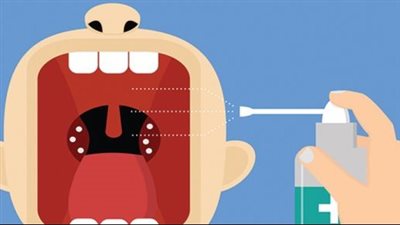 علاج التهاب الحلق الشديد في المنزل بطريقة سهلة وسريعة تعرف عليها 