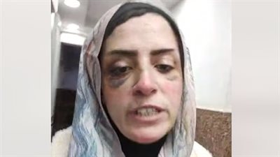 أخبار حوادث اليوم| التحقيق في واقعة الاعتداء على مريض داخل مركز طبي.. والنيابة تنهي خلافا بين زوجين في مغاغة