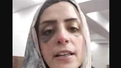 أصابها بكدمات مختلفة.. الأمن يكشف تفاصيل تعدي زوج على زوجته بالمنيا | فيديوجراف