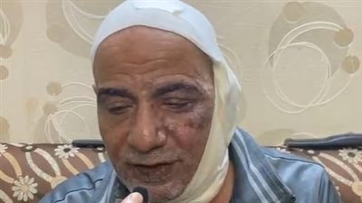 بعد اتهام نجله بإشعال النار بوجهه في المنصورة.. والد المتهم: ابني مالوش ذنب | بث مباشر