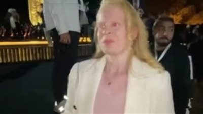 بث مباشر| سالي بعد تكريمها من السيسي بمنتدى شباب العالم: معاناتي مع التنمر استمرت 13 عاما