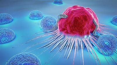  10 علامات لـ أعراض السرطان المبكرة لا ينبغي تجاهلها