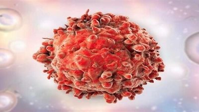 تقارير: انتشار سرطان نادر يصيب الشباب بنسب مرتفعة