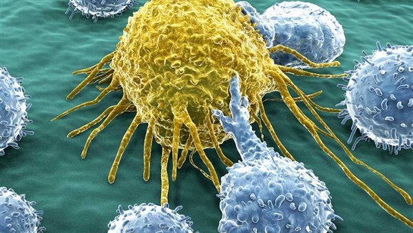 مرض السرطان 