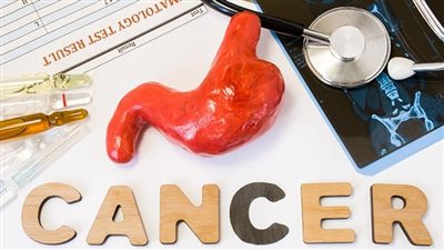 أسباب سرطان المعدة وأعراضه.. 6 عوامل ومحفزات ينبغي تجنبها