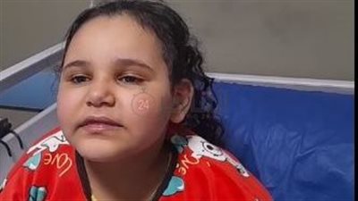 مدير معهد ناصر: جد الطفلة رودينا يعاني من ورم بالوجه.. وجار البدء في العلاج