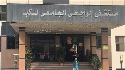 مستشفى الراجحي للكبد بجامعة أسيوط: أجرينا 85 عملية جراحية خلال شهر