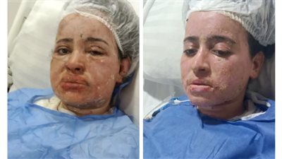 أشعل النار في زوجته بسبب 700 جنيه بكرداسة.. والد الضحية: الزوج اعتاد على ضربها منذ الصباحية