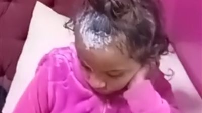 إصابة طفلة بحروق إثر مشاجرة بسبب خلافات على أرض زراعية في بنها