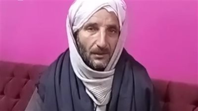 والد الطفلة المصابة بحروق في بنها: بنتي وشها اتدمر دون أي ذنب.. وعايزين القصاص