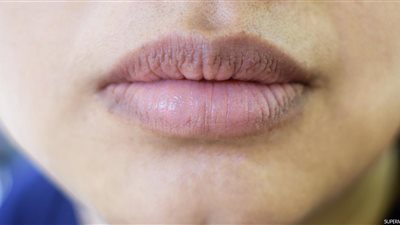 محمد أبو عرابي يكشف طرق إزالة الهالات السوداء من محيط الفم