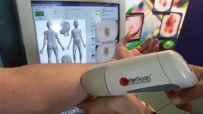 من بينها ظهور بقع حمراء.. تعرف على علامات سرطان الجلد