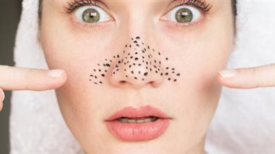 4 وسائل طبيعية للتخلص من البثور الجلدية.. منها زيت الشاي والنيم الهندي