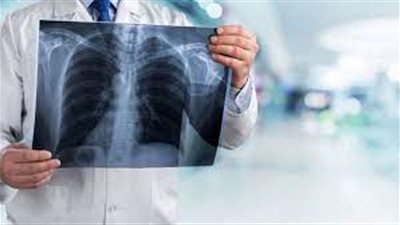 استشاري أمراض صدرية يكشف أسباب الإصابة بالتهابات الشعب الهوائية