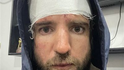 نقابة الزبالين: ما حدث مع الصحفي الروسي سوء تقدير للموقف.. وندعوه لزيارة مصر مرة أخرى