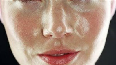 3 طرق علاجية لحماية البشرة الدهنية في فصل الصيف