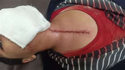 تأكيدًا لـ القاهرة 24.. إيقاف مدير مدرسة الاعتداء على طالب الابتدائي بالإسكندرية