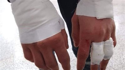 السبب كمامة.. اعتداء طالب على زميله داخل المدرسة بحدائق القبة