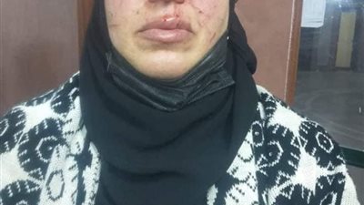  سيدة تعرضت للضرب علي يد أبناء زوجها بالدقهلية: بعد ما ربيتهم رموني في الشارع وقطعوا عنّي الكهربا