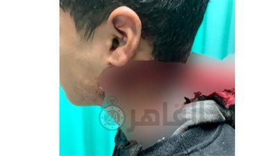 150 غرزة في الرقبة.. ننشر التقرير الطبي لواقعة تعدي طالب ثانوي على زميله بأكتوبر| صور