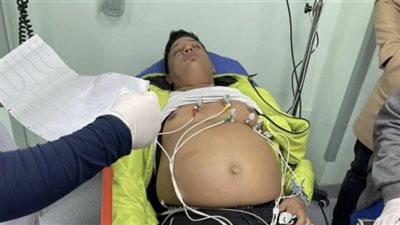 بعد تعرض حمو بيكا لأزمة صحية بسببه.. ما هو مرض الكرونز؟ | فيديو