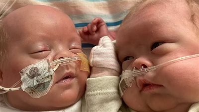 مقاتلون صغار.. بريطانية تلد توأمًا بالأسبوع الـ 22 من الحمل في حدث نادر لا يتكرر