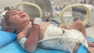 تشخيص عن بعد.. الصحة تتعاون مع التعليم العالي لإنقاذ حياة طفل حديث الولادة يعاني من نزيف بالمخ