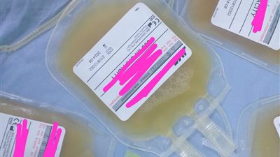 بلازما ومواد تحاليل مجهولة.. تفاصيل غلق وتشميع بنك دم بمستشفى خاص في سوهاج | صور