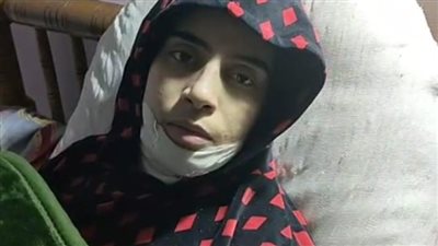 بث مباشر| نورا العراقية ضحية زوجها في حدائق المعادي: شوه وجهي بمياه مغلية لرفضي بيع المخدرات