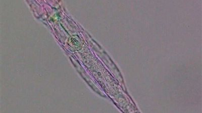 القومي للبحوث: نشارك في مشروع الجنيوم المصري بقراءة بعض الأحماض البشرية