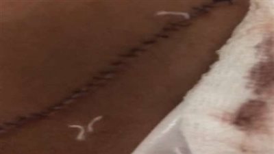 بسبب فتاة.. الأمن يكشف تفاصيل تعدي طالب على صديقه بـ كاتر في المعصرة