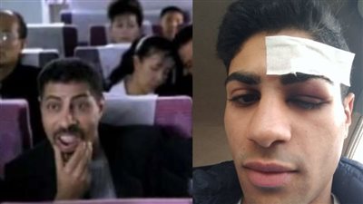 تفاصيل تعرض نجل أمير شاكر للاعتداء في أكتوبر: عينه كانت هتروح